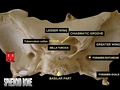 Sphenoid bone superior view