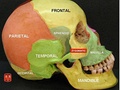 Sphenoid bone