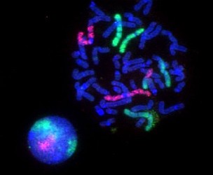 Fluorescence microscopy images of sun flares pathology in a blood cell showing the affected areas in red.