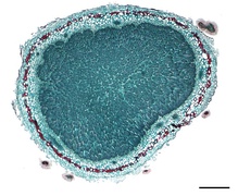 Cross section of the nodule.