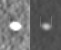 Measurement of a 5.6 mm large kidney stone in soft tissue versus skeletal CT window.