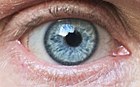 Eye color is an inherited trait influenced by more than one gene, including OCA2 and HERC2. The interaction of multiple genes—and the variation in these genes ("alleles") between individuals—help to determine a person's eye color phenotype. Eye color is influenced by pigmentation of the iris and the frequency-dependence of the light scattering by the turbid medium within the stroma of the iris.