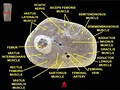 Muscles of thigh. Cross section.