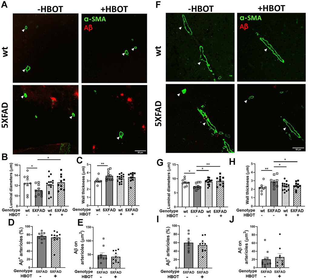 HBOT attenuates arteriolar luminal diameter but not amyloid deposition around arterioles in 6-month old 5XFAD mice. Arterioles were visualized using immunostaining with anti-SMA antibody while vascular amyloid deposition was visualized using anti-Aβ antibody (4G8). (A, F) Representative images of arterioles and Aβ in hippocampal (A) and cortical fields (F) of HBO-treated wt (n=9, upper right panels) and 5XFAD mice (n=10, lower right panels) and control wt (n=9, upper left panels) and 5XFAD mice (n=10, lower left panels) (x40 magnification, scale bar: 50 μm). White arrows show hippocampal and cortical arterioles. (B–E) and (G–J), Quantification of arteriolar luminal diameters (B, G), arteriolar wall thickness (C, H) and percentages of arterioles that stained positive for Aβ (D, I) and Aβ deposition area around arterioles (E, J) in the hippocampal (B–E) and cortical fields (G–J). Two-way ANOVA and post-hoc Fisher LSD tests were performed. Values represent means ± SEM. * P P 