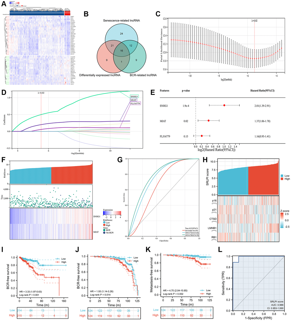 SRLPI identification and its clinical applications. (A) heatmap showing differentially expressed lncRNAs between tumor and normal samples in TCGA database; (B) Venn plot showing the intersection of senescence-related, differentially expressed and BCR-related lncRNAs; (C) lasso regression analysis showing the optimal lambda for the model; (D) lasso regression analysis showing the lncRNAs in the optimal model; (E) multivariate Cox regression analysis showing the prognostic lncRNAs used to construct the SRLPI score in terms of biochemical recurrence-free survival; (F) risk factor plot showing the distribution of outcomes and final lncRNAs in the SRLPI score; (G) time-dependent ROC curve showing the diagnostic ability of SRLPI score for BCR identification of PCa patients; (H) heatmap showing relationship of SRLPI score with common senescence markers; (I) Kaplan-Meier curve showing the survival difference of high- and low- SRLPI groups for PCa patients in TCGA database; (J) Kaplan-Meier curve showing the BCR-free survival difference of high- and low- SRLPI groups for PCa patients in GSE116918; (K) Kaplan-Meier curve showing the metastasis-free survival difference of high- and low- SRLPI groups for PCa patients in GSE116918; (L) ROC curve showing the diagnostic accuracy of SRLPI score for radiotherapy sensitivity in PCa patients. Abbreviations: SRLPI: senescence-related lncRNA prognostic index; BCR: biochemical recurrence; ROC: receiver operating characteristic curve; lncRNA: long non-coding RNA; PCa: prostate cancer. Note: prostate cancer patients were divided into high- and low- risk groups according to the median value of SRLPI score.