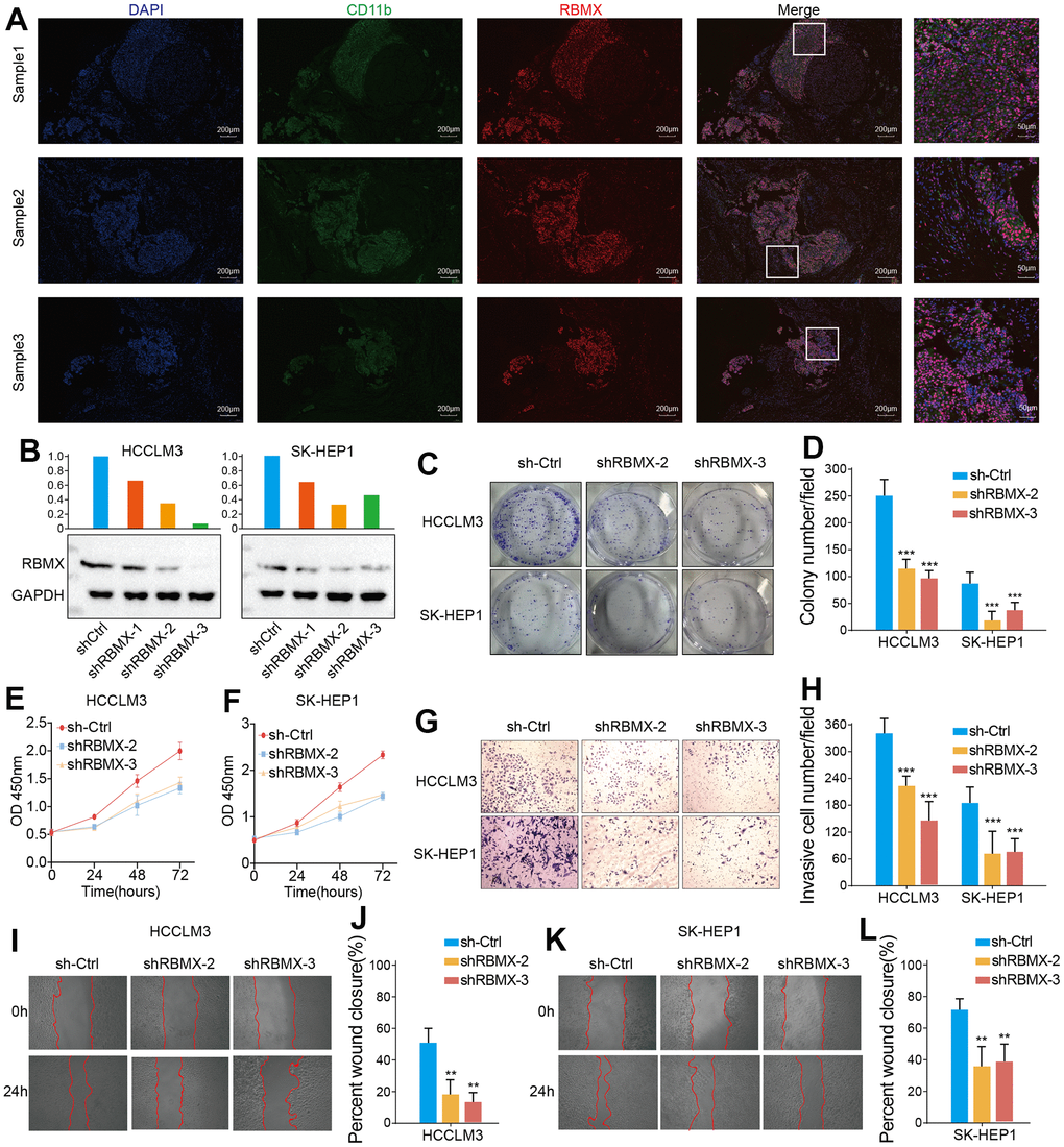 TIMER immune cell infiltration analysis. Heatmap illustrating the correlations of RBMX expression with the infiltration levels of CD4+ T cells, CAF, progenitor, Endo, Eos, HSC, Tfh, gdT, NKT, regulatory T cells (Tregs), B cells, neutrophils, monocytes, macrophages, dendritic cells, NK cells, mast cells, and CD8+ T cells in the pan-cancer setting. Red and blue squares indicate positive and negative correlations, respectively. CAF, cancer-associated fibroblasts; Endo, endothelial cells; Eos, eosinophils; gdT, γ/δT cells; HSC, hematopoietic stem cells; NK, natural killer; NKT natural killer T; RBMX, RNA binding motif protein X-linked; TIMER, Tumor IMmune Estimation Resource; Tfh, follicular helper T cells.