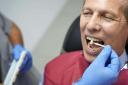 Teeth whitening is becoming increasingly popular among middle-aged and older people, data suggests (Alamy/PA)