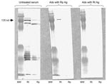 Thumbnail of Western blot assay and cross-adsorption studies of an immunofluoresence assay–positive serum sample from a patient with rickettsiosis in Algeria. Antibodies were detected at the highest titer (immunoglobulin [Ig] G 256, IgM 256) for both Rickettsia typhi and R. prowazekii antigens. Columns Rp and Rt, Western blots using R. prowazekii and R. typhi antigens, respectively. MW, molecular weight, indicated on the left. When adsorption is performed with R. typhi antigens (column Ads with Rt Ag), it results in the disappearance of the signal from homologous and heterologous antibodies, but when it is performed with R. prowazekii antigens (column Ads with Rp Ag), only homologous antibody signals disappear, indicating that the antibodies are specific for R. typhi.