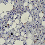 Representative bat lung tissue showing Ebola virus (EBOV) cytoplasmic granules in study of histopathologic changes in Mops condylurus bats naturally infected with Bombali virus, Kenya. We labeled lung tissue sections by using rabbit polyclonal serum against EBOV matrix protein VP40 and detected antigen by using a chromogenic horse radish peroxidase substrate. The sections were then counterstained with hematoxylin. Arrow indicates granular cytoplasmic immunopositivity for EBOV VP40 antigen. Original magnification ×400. VP, viral protein.