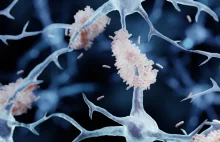 Spray do nosa może oczyścić mózg z białek charakterystycznych dla Alzheimera!