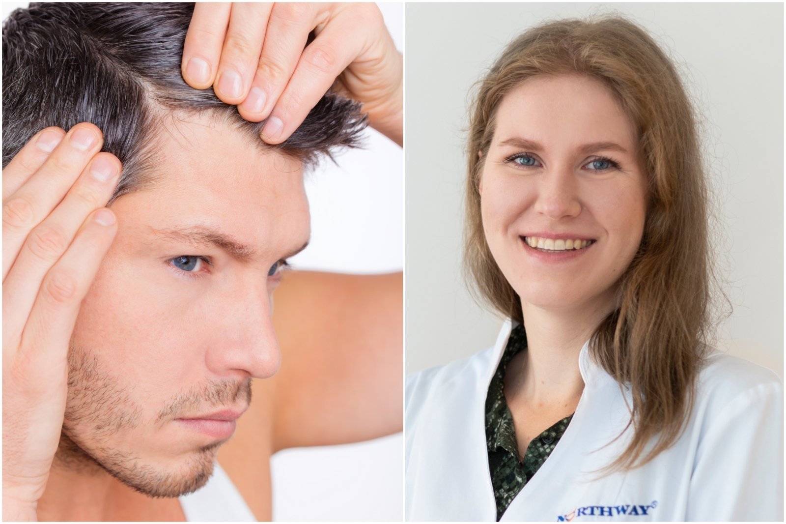 Vyrai pradeda plikti vis jaunesni: gydytoja atsakė, ar verta naudoti priemones nuo plaukų slinkimo