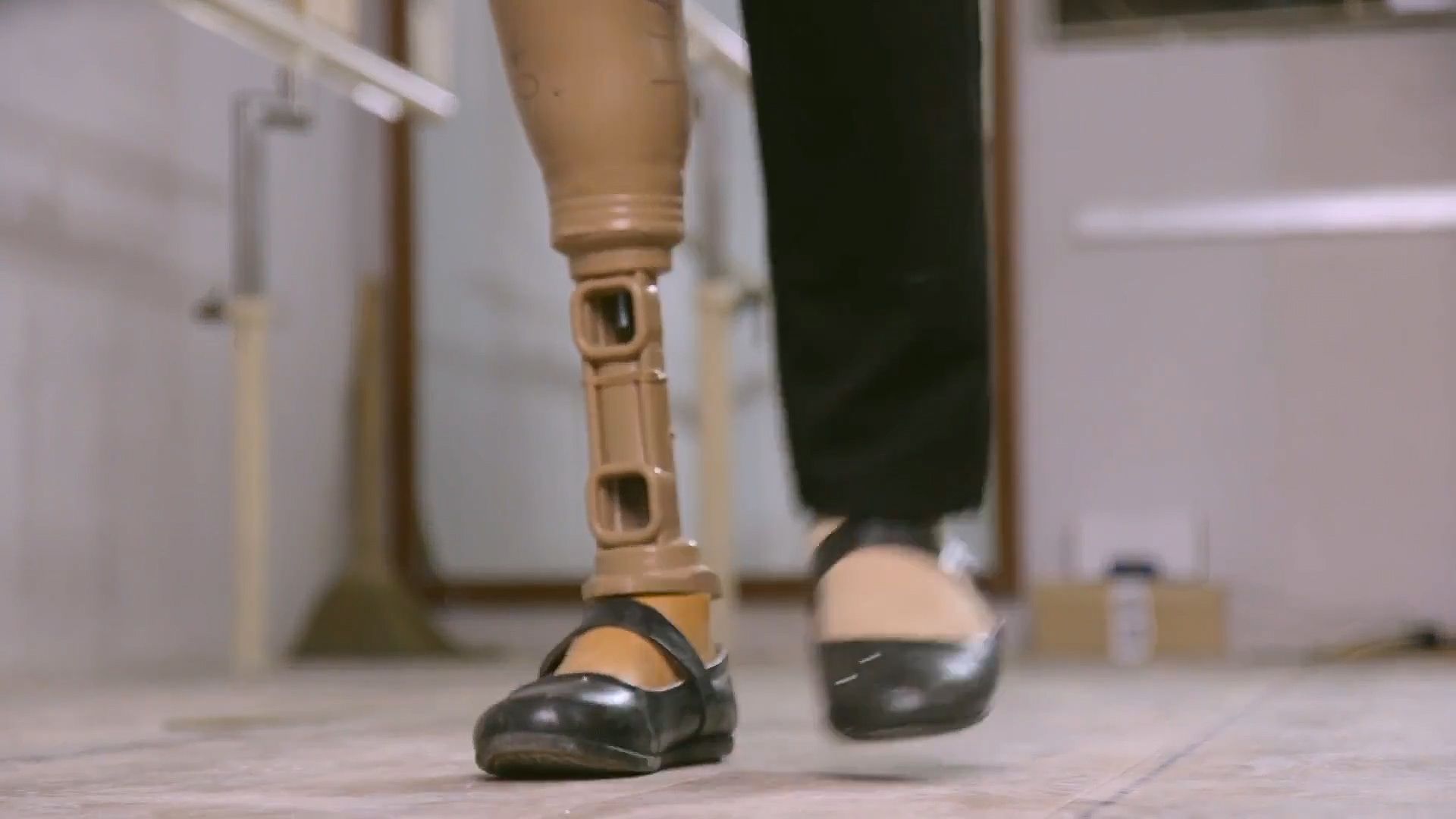 Know about an effort to make portable and low-cost prosthetic limbs