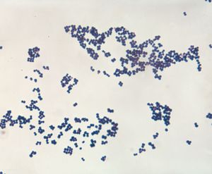 Staphylococcus aureus; human microbiome