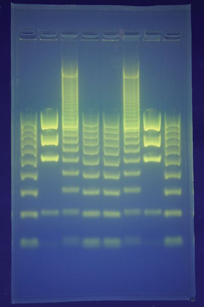 In DNA fingerprinting, fragments of DNA are separated on a gel using a technique called electrophoresis. This creates a pattern that can be analyzed and that is unique to each individual, with the exception of identical twins.