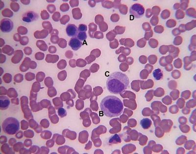 bone marrow smear showing myelocytes