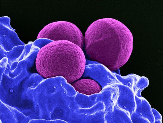 MRSA and neutrophil