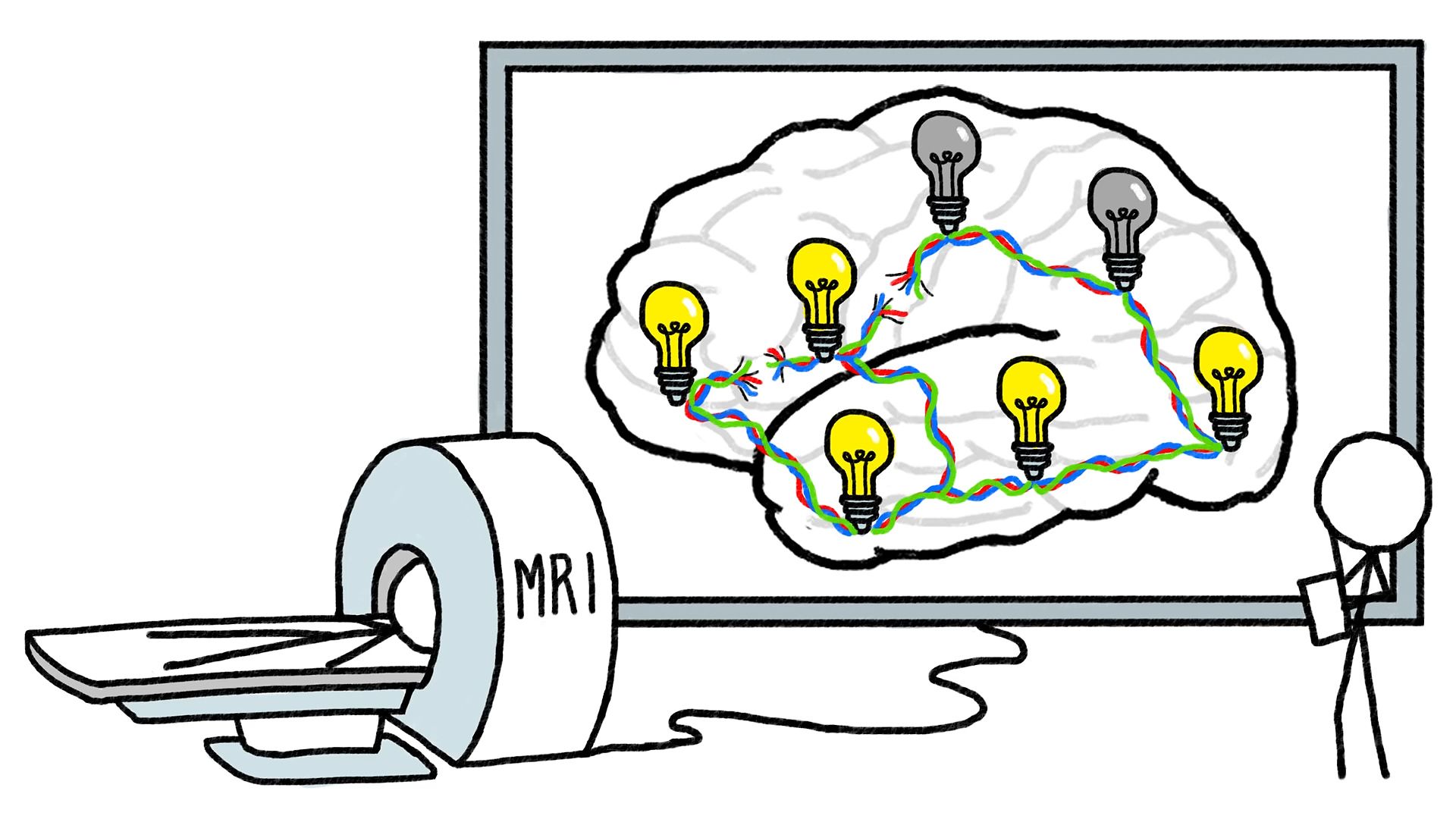 Know Broca's lesion method in mapping brain activity in humans and how studies of brain disorders to the Broca area help evolve the scientific understanding of cognition