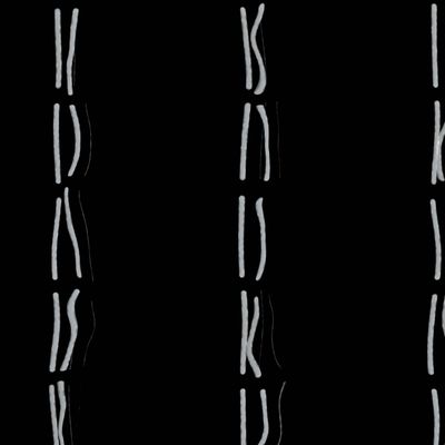 chromosome