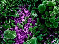 Novel Coronavirus SARS-CoV-2 - Colorized scanning electron micrograph of an apoptotic cell (green) heavily infected with SARS-COV-2 virus particles (purple), isolated from a patient sample. Image captured and color-enhanced at the NIAID Integrated...