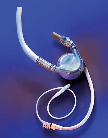 HeartMate Left Ventricular Assist System