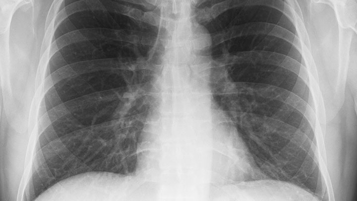 pulmonary-medicine img