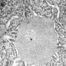 Image of rabies virus and relatives