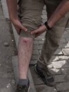 Gazetari i plagosur thotë se policia gjeorgjiane përdori plumba gome kundër protestuesve