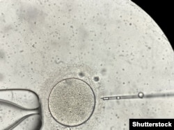Оплодотворение яйцеклетки под микросокопом