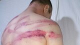 Виталий Бунтов, в очередной раз подвергнутый пыткам сотрудниками администрации колонии ИК-12 Пермского края 