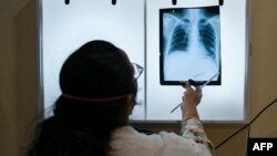 Doktor provjerava rendgenski snimak grudnog koša pacijenta s dijagnozom tuberkuloze na klinici Ljekari bez granica u Mumbaiju.