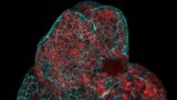 This microscope image provided by researchers in March 2024 shows a lung organoid created from cells collected from amniotic fluid. (Giuseppe Calà, Paolo De Coppi, Mattia Gerli via AP)