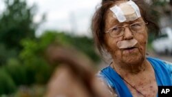 Valentyna Kondratieva, 75, points to her damaged home, Aug. 13, 2022, where she was injured in a Russian rocket attack in Kramatorsk, Donetsk region, eastern Ukraine.