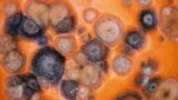 This image provided by Bugwood.org shows a pumpkin displaying lesions symptomatic of anthracnose, a serious fungal disease.(Gerald Holmes, Strawberry Center, Cal Poly San Luis Obispo, Bugwood.org via AP)