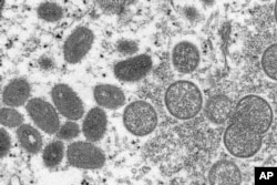 his 2003 electron microscope image made available by the Centers for Disease Control and Prevention shows mature, oval-shaped monkeypox virions.