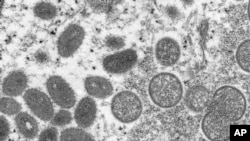 원숭이두창 바이러스의 전자현미경 사진.