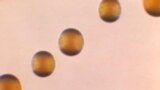 FILE - This 1966 microscope photo shows five colonies of Group-B Neisseria meningitidis bacteria. (Dr. Brodsky/CDC via AP)