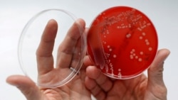 Quiz - Drug-resistant Infections, Deaths Rose in 2020
