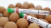 ARCHIVO - Tubos de ensayo etiquetados como "Gripe aviar" y huevos se ven en esta ilustración, el 14 de enero de 2023.