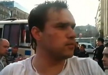 Дмитрий Монахов после избиения полицейскими. Кадр видео с youtube-канала газеты "Совершенно секретно"