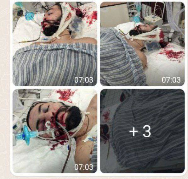 Террориста, устроившего циничное выступление с "черепом защитника Мариуполя", догнала "карма": ему прострелили голову. Фото