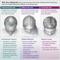 Common Causes of Hair Loss Hair Loss, Diffuse Hair Loss, Androgenetic Alopecia, Hormones, Dermatology, Autoimmune Disorder, Scalps, Face And Body