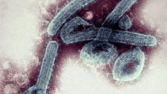 The Marburg virus was first detected in Marburg town in West Germany in 1967