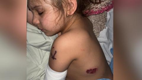 Rayven asleep in a hospital bed with scratches on her side and a bandage on her arm
