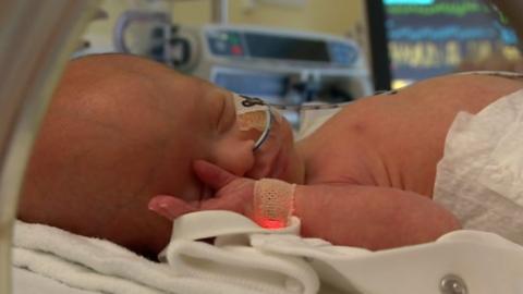 Baby in incubator