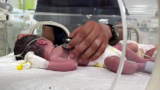 ラファの産科病院の医師らが緊急帝王切開手術を行い、赤ちゃんを助けた