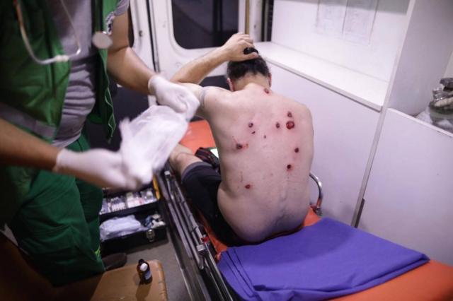 Гурам Мурадов получил множественные ранения от резиновых пуль