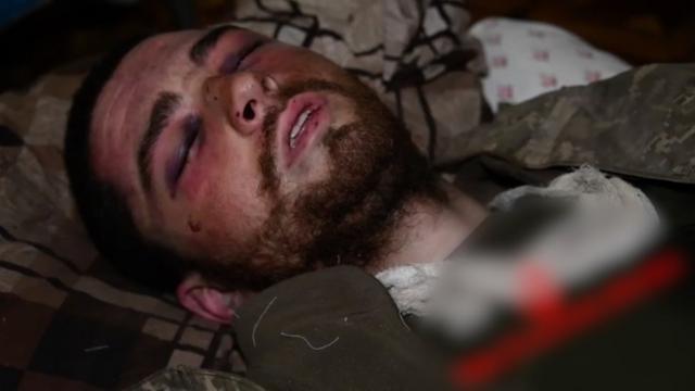 Image of Hlib Stryzhko lying injured with eyes closed