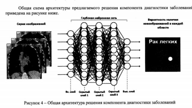 нейросеть