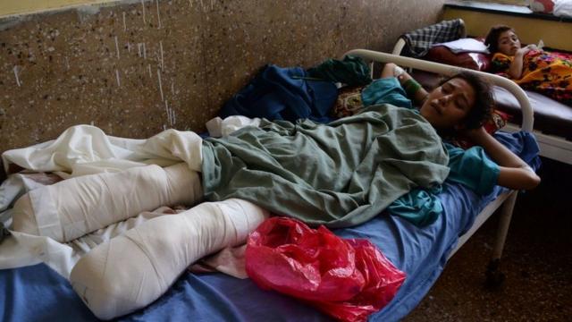 Раненая афганская девушка