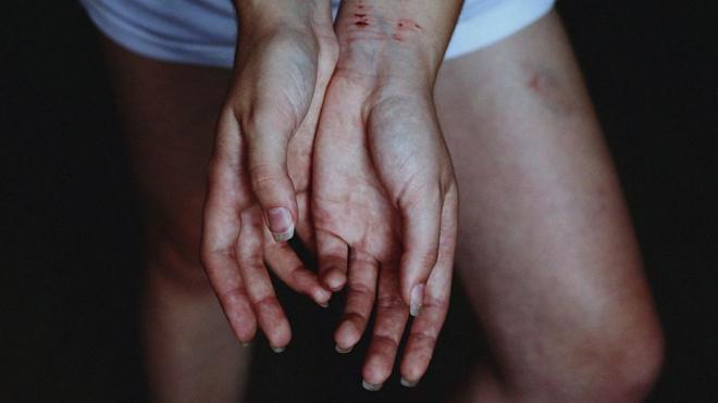 руки жертвы насилия